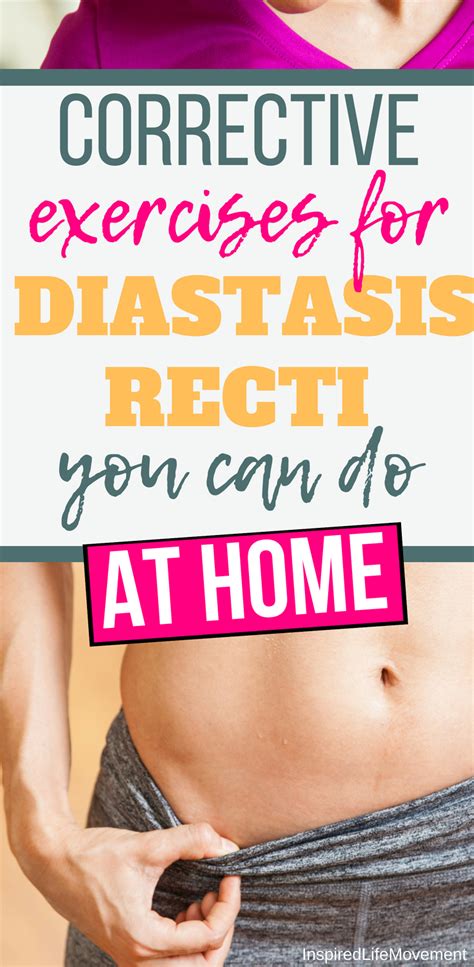 my stomach is too soft to test for diastasis recti|does diastasis recti go away.